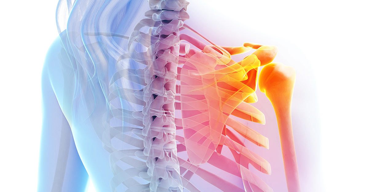 Gadsden shoulder pain treatment and recovery
