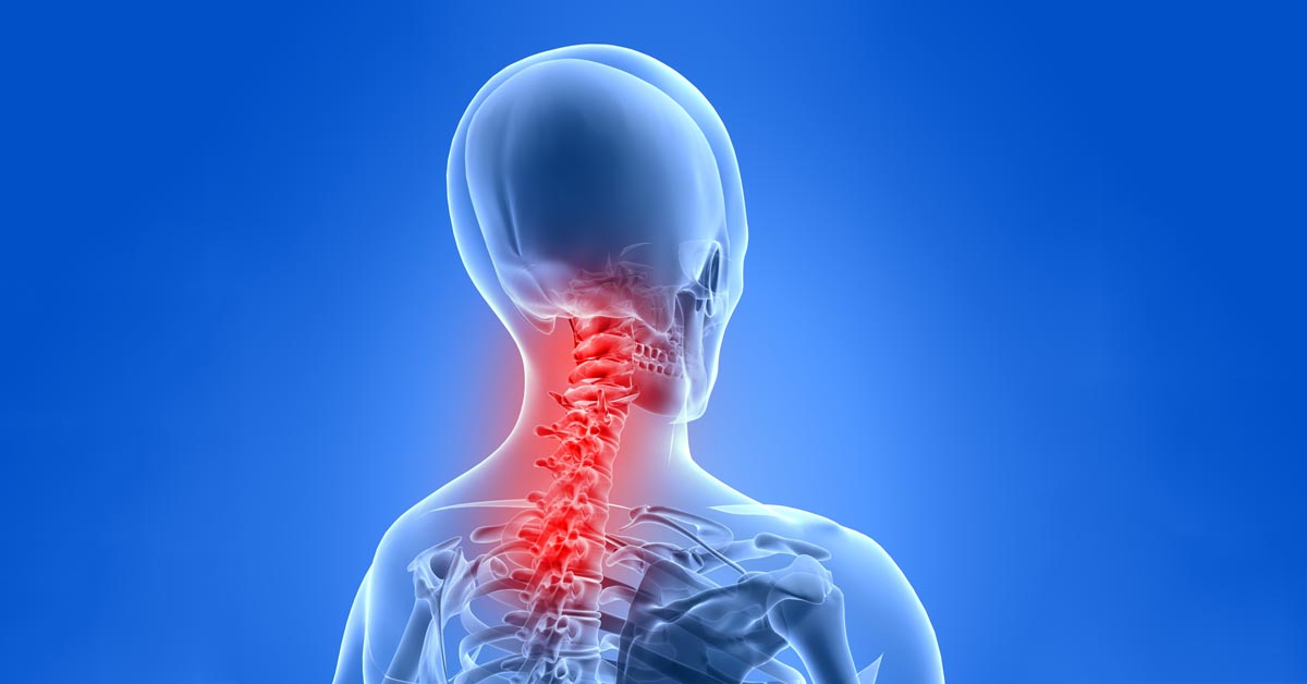 Gadsden, AL car accident and neck pain treatment